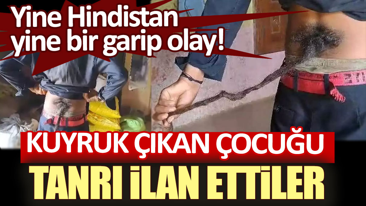 Yine Hindistan, yine bir garip olay! Kuyruk çıkan çocuğu Tanrı ilan ettiler