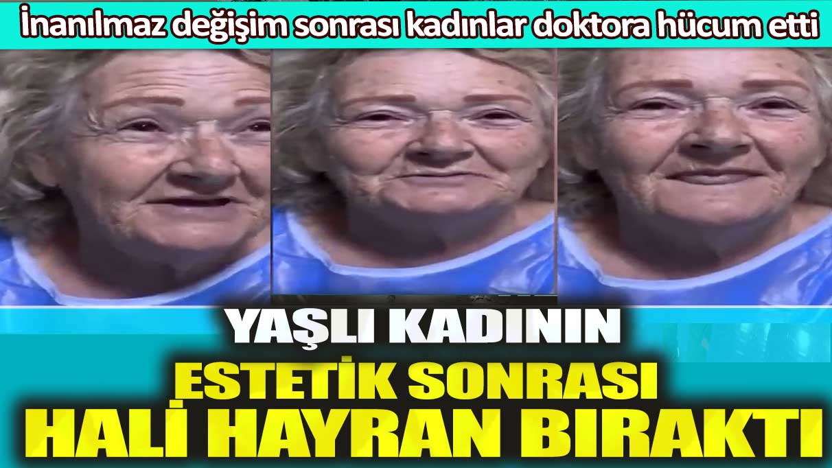 Yaşlı kadının estetik sonrası hali hayran bıraktı: İnanılmaz değişim sonrası kadınlar doktora hücum etti