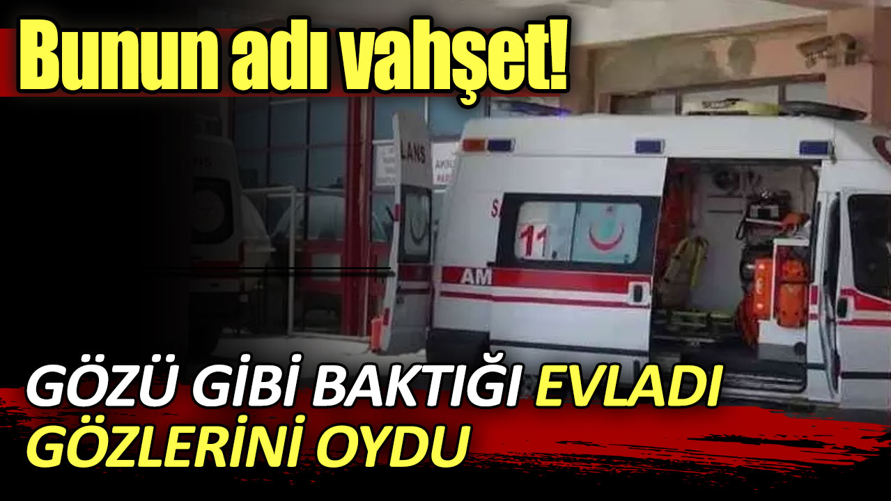 Bunun adı vahşet! Gözü gibi baktığı oğlu, gözlerini oydu