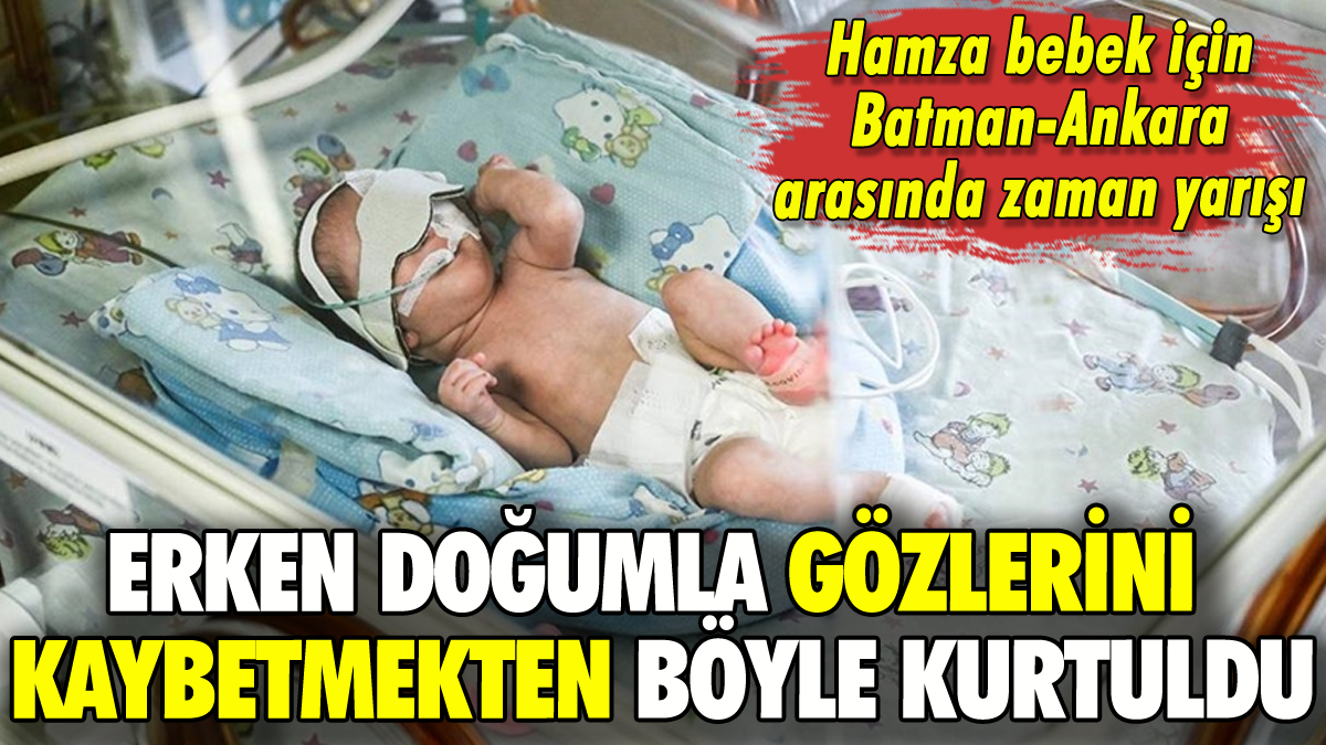 Erken doğumda görmeme tehlikesi: Hamza bebek bu yöntemle kurtuldu