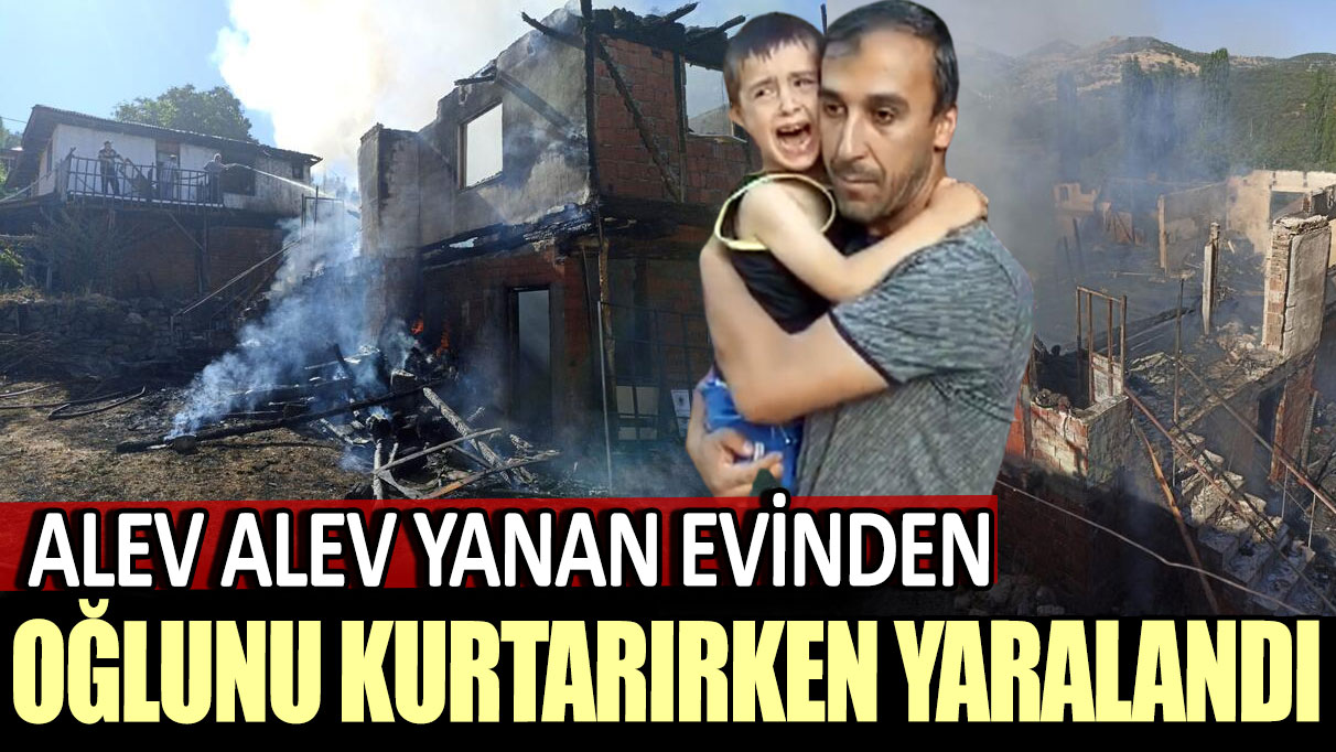 Alev alev yanan evinden oğlunu kurtarırken yaralandı!