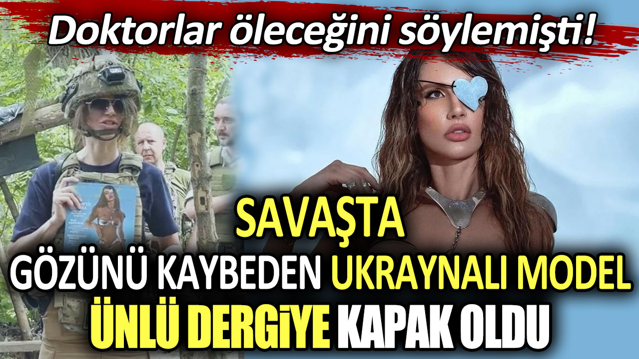 Doktorlar öleceğini söylemişti! Savaşta gözünü kaybeden Ukraynalı model ünlü dergiye kapak oldu