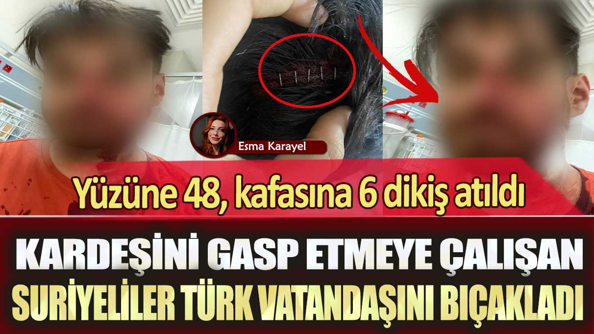 Gaziantep’te kardeşini gasp etmeye çalışan Suriyeliler Mustafa Aydaş’ı bıçakladı: Yüzüne 48, kafasına 6 dikiş atıldı