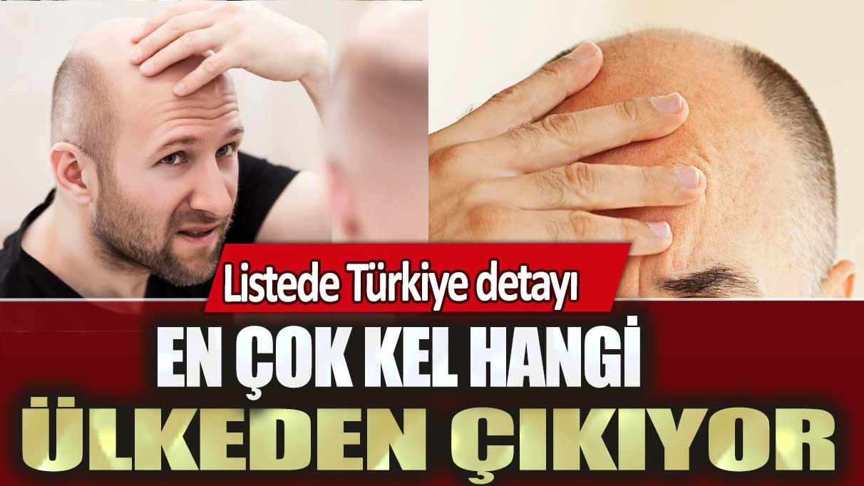 En çok kel hangi ülkeden çıkıyor: Listede Türkiye detayı