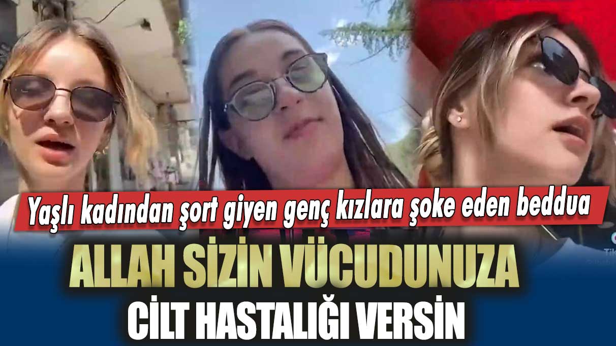 Yaşlı kadından şort giyen genç kızlara şoke eden beddua: Allah sizin vücudunuza cilt hastalığı versin