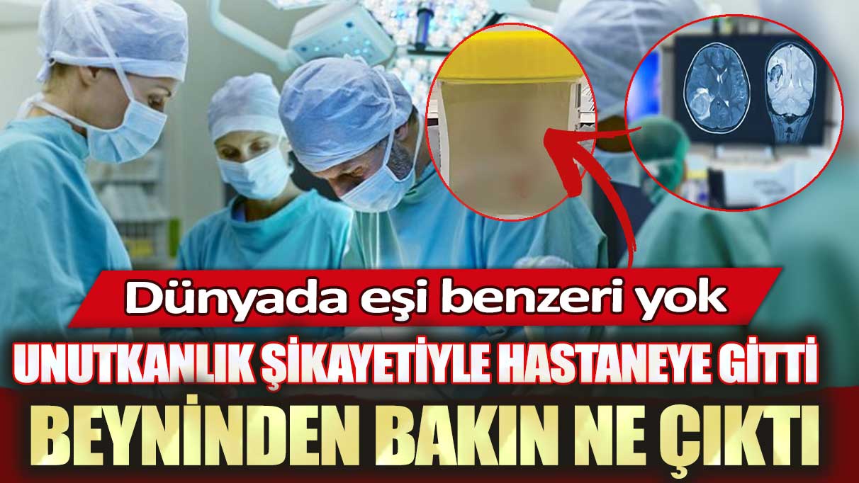 Unutkanlık şikayetiyle hastaneye gitti beyninden bakın ne çıktı: Dünyada eşi benzeri yok