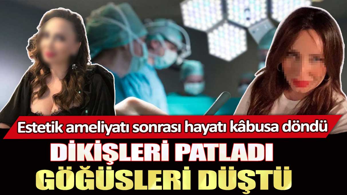 Estetik ameliyatı sonrası hayatı kâbusa döndü: Dikişleri patladı göğüsleri düştü