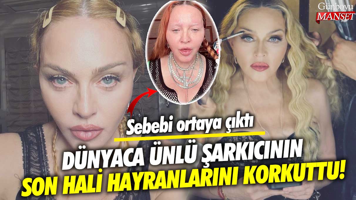 Dünyaca ünlü şarkıcı Madonna'nın son hali hayranlarını korkuttu! Sebebi ortaya çıktı