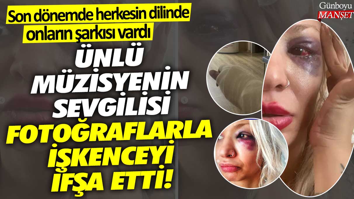 Ünlü müzisyenin sevgilisi fotoğraflarla işkenceyi ifşa etti! Son dönemde herkesin dilinde onların şarkısı vardı