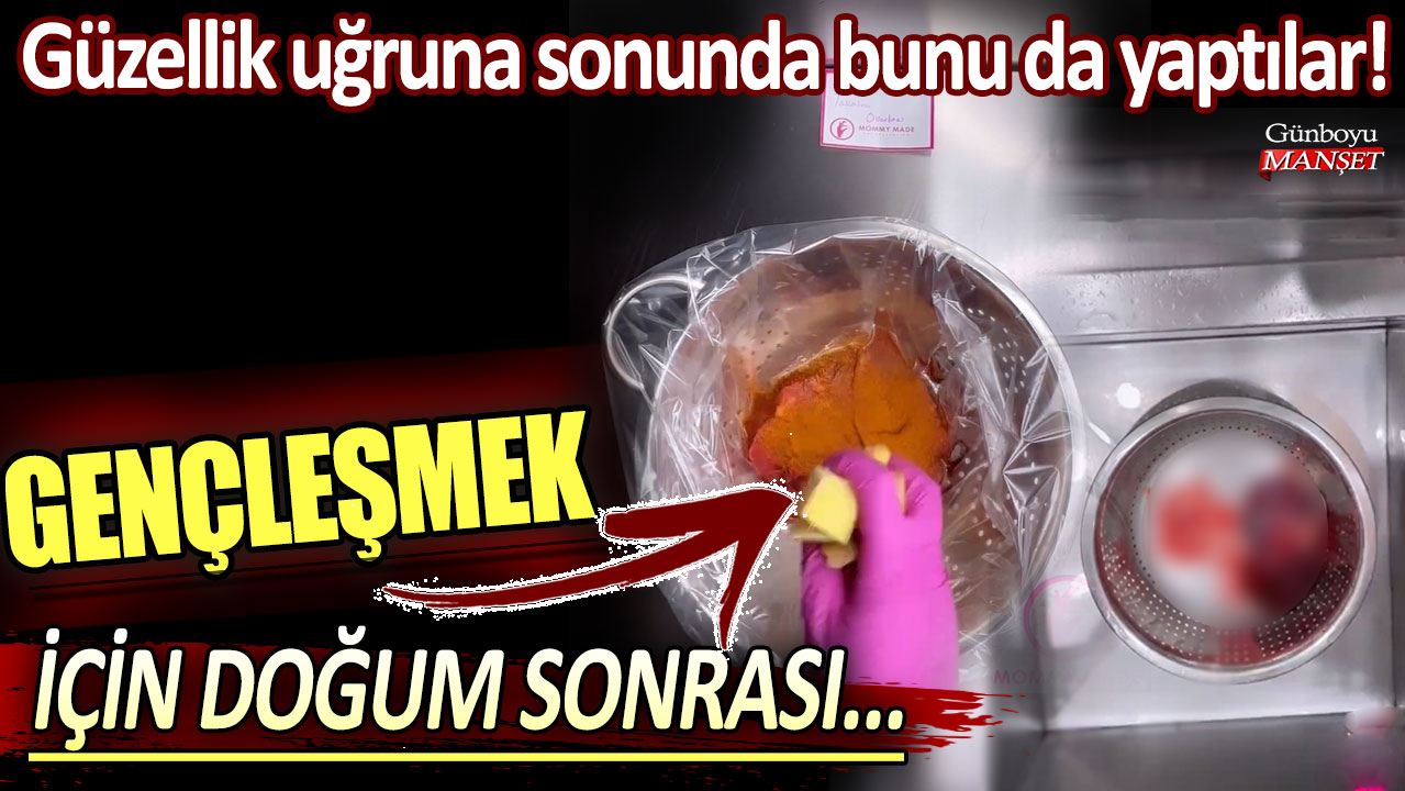 Güzellik uğruna sonunda bunu da yaptılar: Gençleşmek için doğum sonrası...