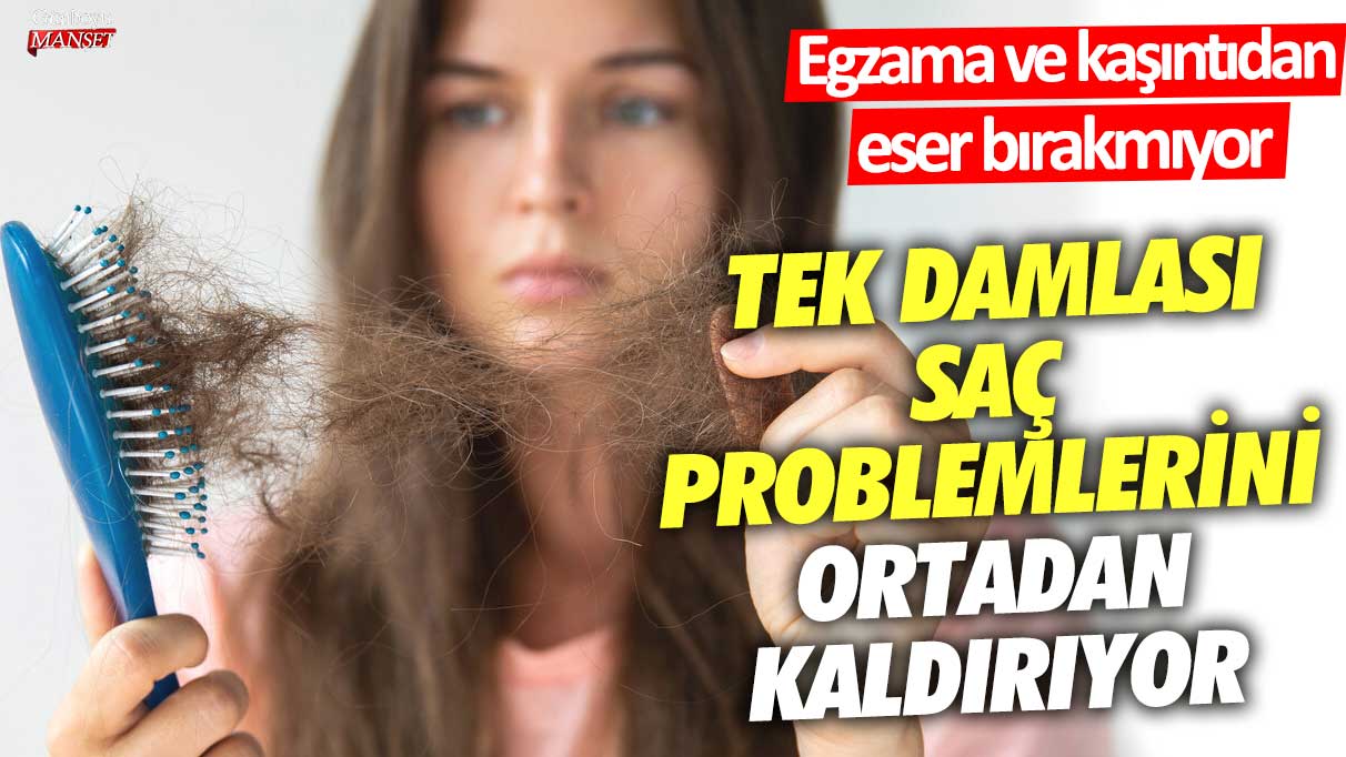 Tek damlası saç problemlerini ortadan kaldırıyor! Egzama ve kaşıntıdan eser bırakmıyor