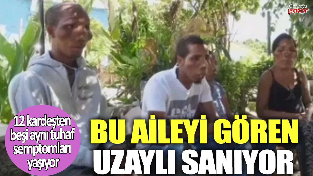 Bu aileyi gören uzaylı sanıyor! 12 kardeşten beşi aynı tuhaf semptomları yaşıyor