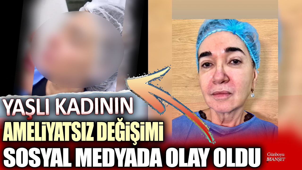 Yaşlı kadının ameliyatsız değişimi sosyal medyada olay oldu