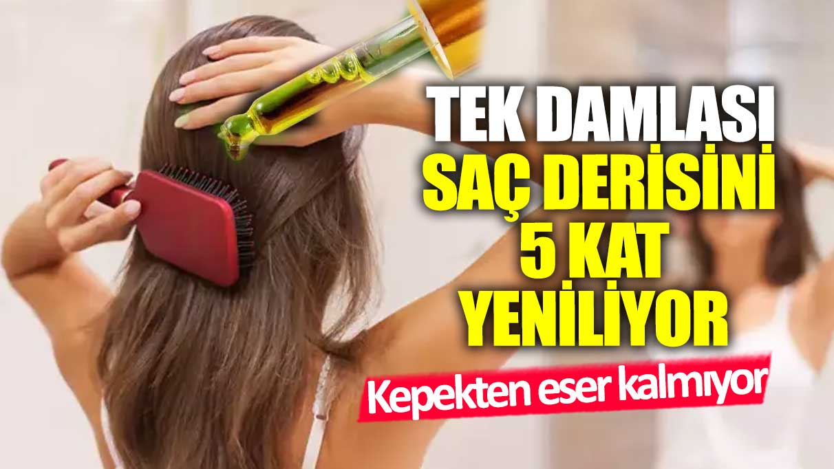 Kepekten eser kalmıyor! Tek damlası saç derisini 5 kat yeniliyor