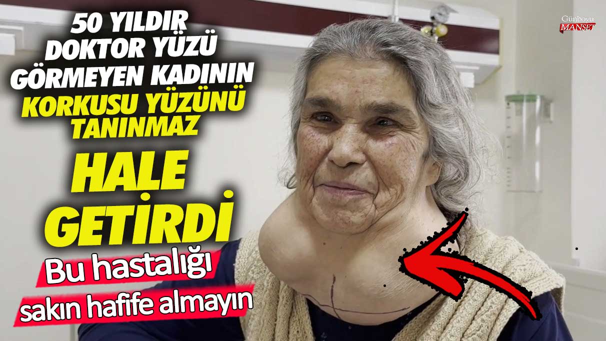 50 yıldır doktor yüzü görmeyen kadının korkusu yüzünü tanınmaz hale getirdi! Bu hastalığı sakın hafife almayın