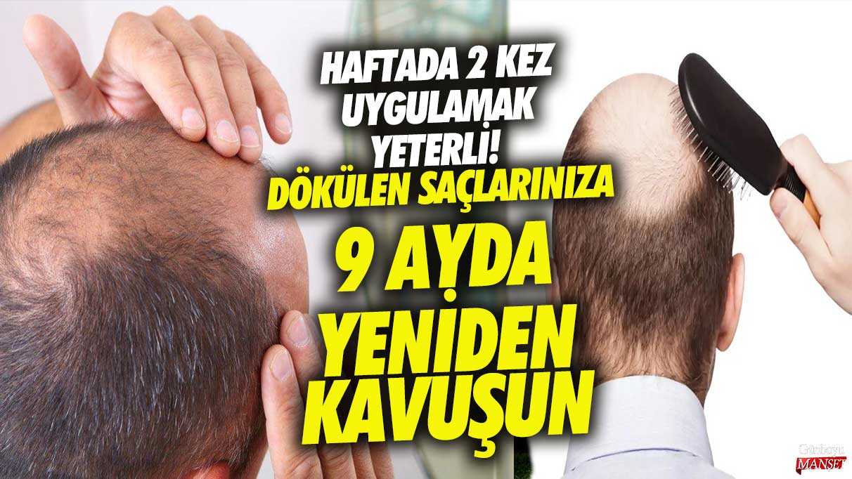 Dökülen saçlarınıza 9 ayda yeniden kavuşun! Haftada 2 kez uygulamak yeterli