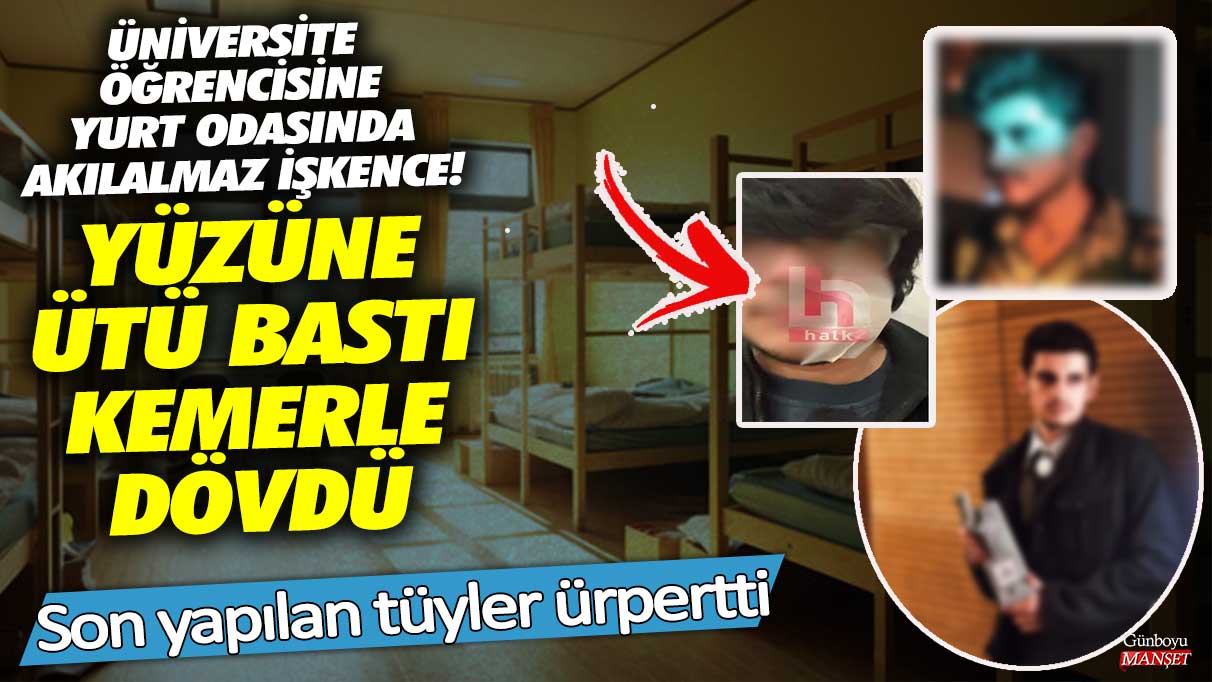 Üniversite öğrencisine yurt odasında akılalmaz işkence! Yüzüne ütü bastı kemerle dövdü