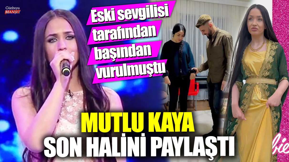 Eski sevgilisi tarafından başından vurulmuştu! Mutlu Kaya son halini paylaştı