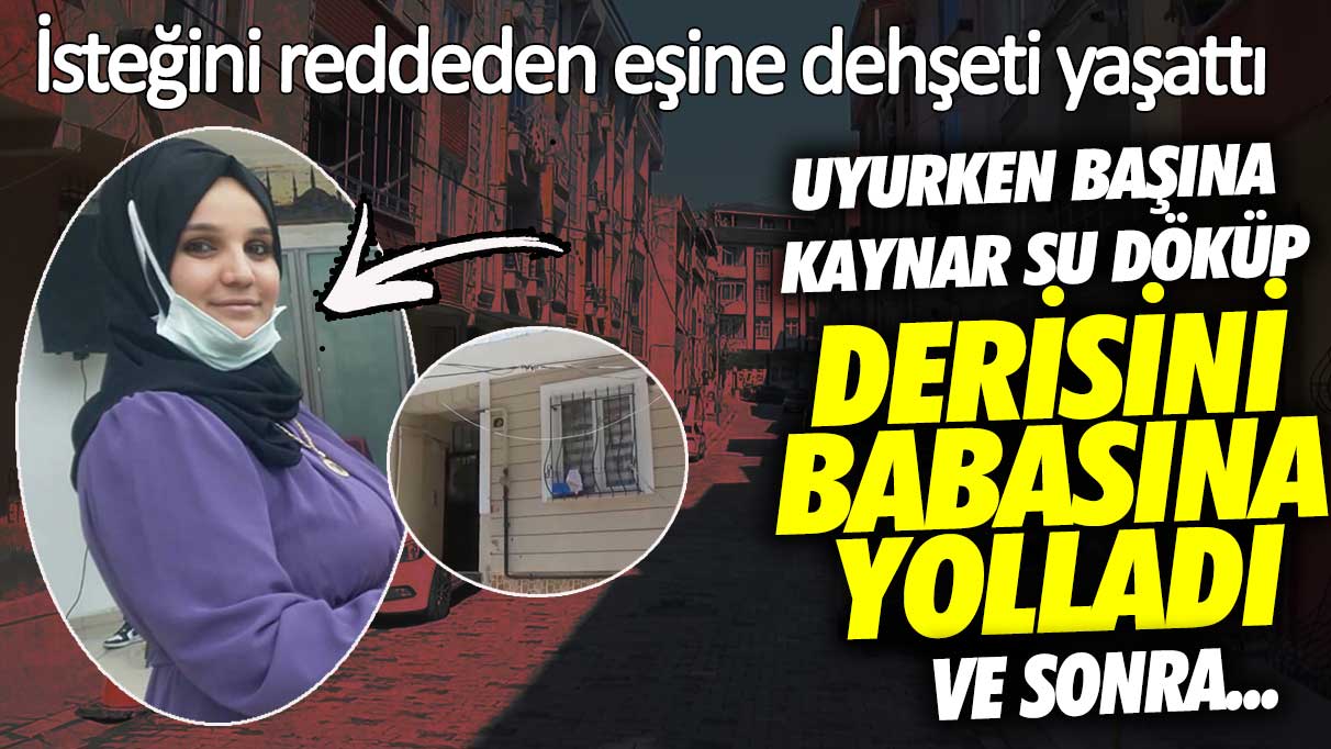 İsteğini reddeden eşine dehşeti yaşattı! Başına kaynar su döküp derisini babasına yolladı ve sonra