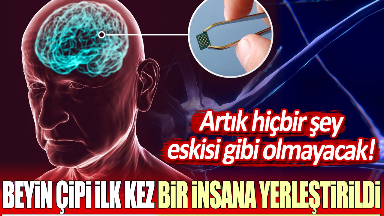 Neuralink beyin çipi ilk kez bir insana yerleştirildi! Artık hiçbir şey eskisi gibi olmayacak...