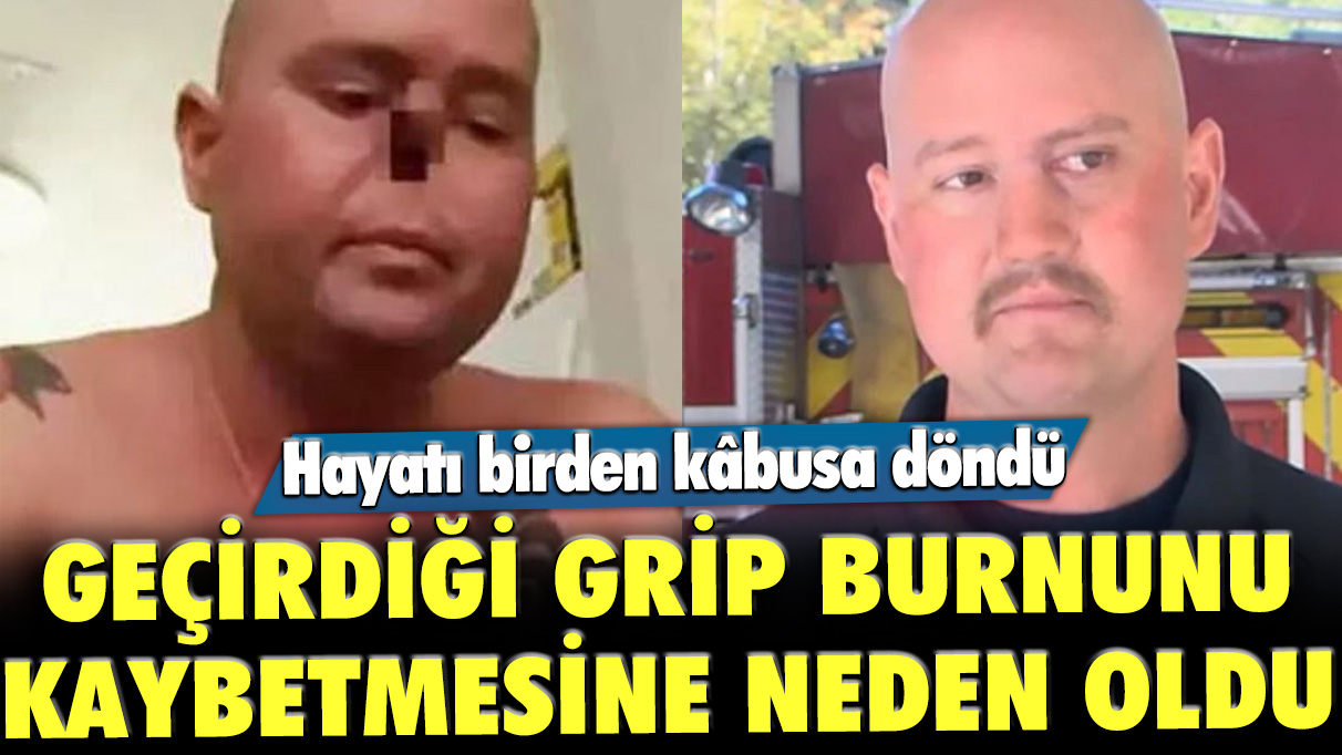 Geçirdiği grip burnunu kaybetmesine neden oldu: Hayatı birden kâbusa döndü