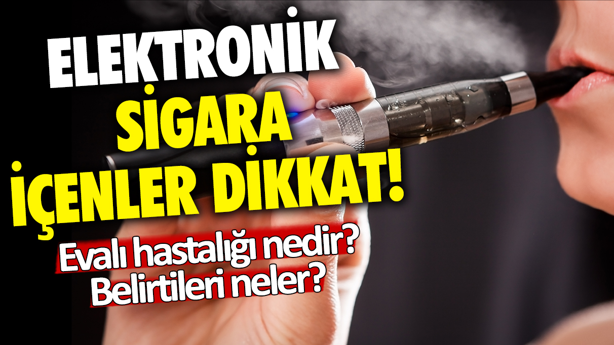 Elektronik sigara içenlerde görülen Evalı hastalığı nedir? Evalı hastalığının belirtileri neler?