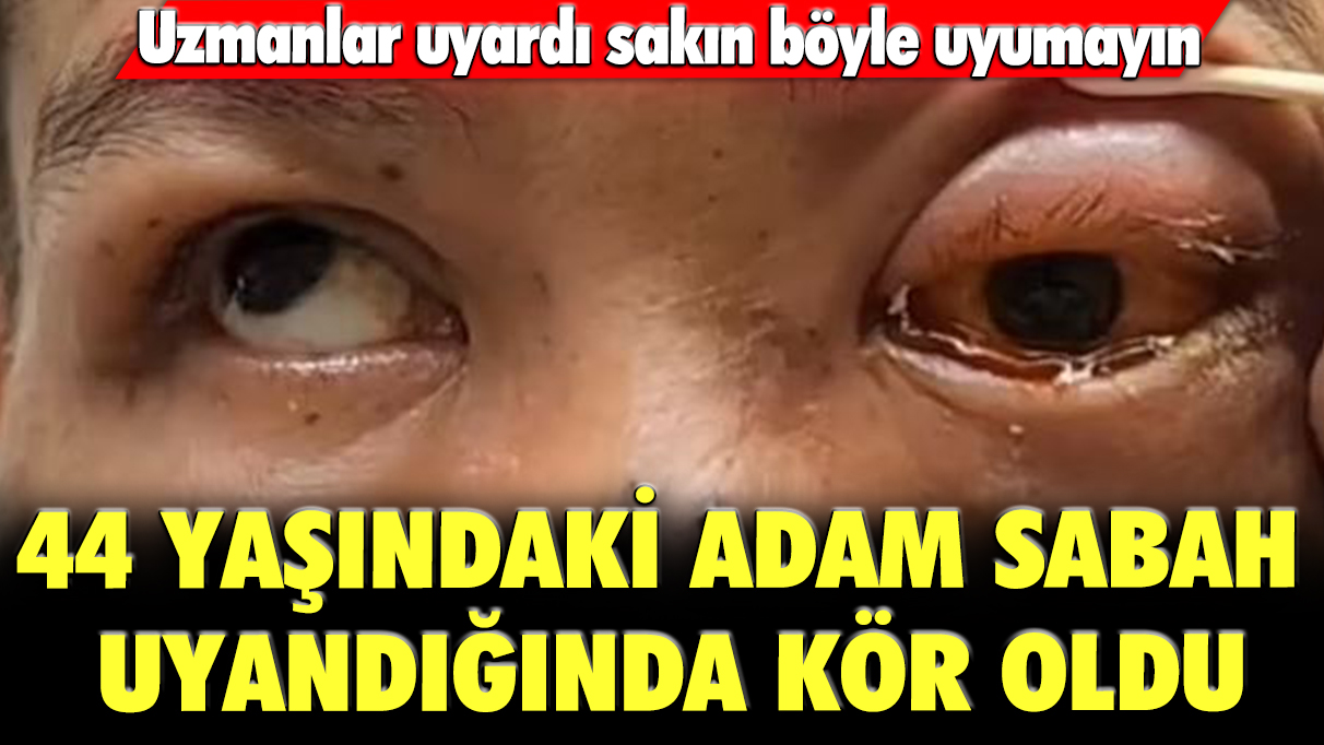 Uzmanlar uyardı sakın böyle uyumayın: 44 yaşındaki adam sabah uyandığında kör oldu