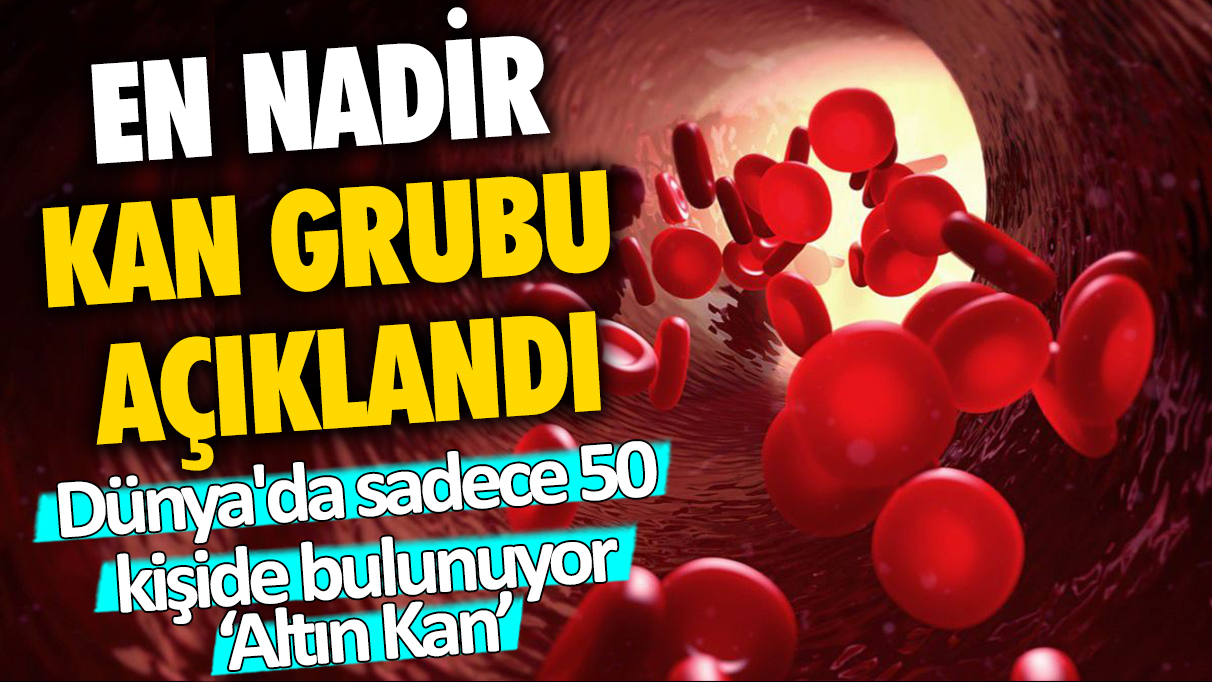 En nadir kan grubu açıklandı: Dünya'da sadece 50 kişide bulunuyor! Altın Kan