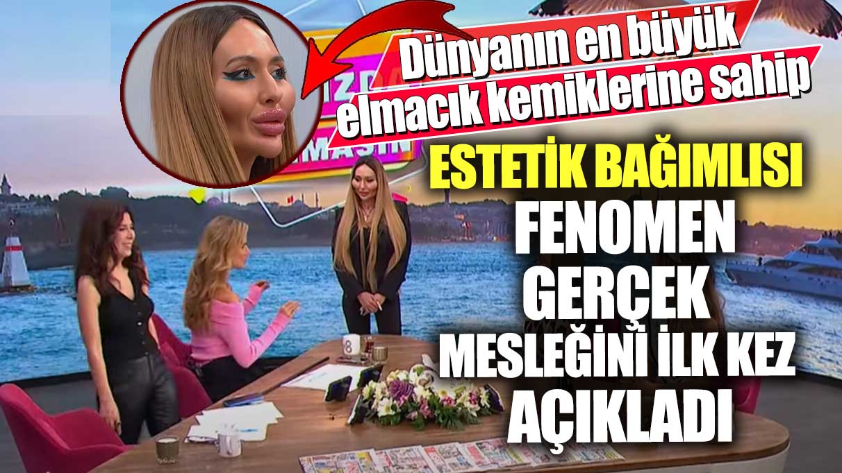 Dünyanın en büyük elmacık kemiklerine sahip! Estetik bağımlısı fenomen Anastasia Pokreshchuk gerçek mesleğini ilk kez açıkladı