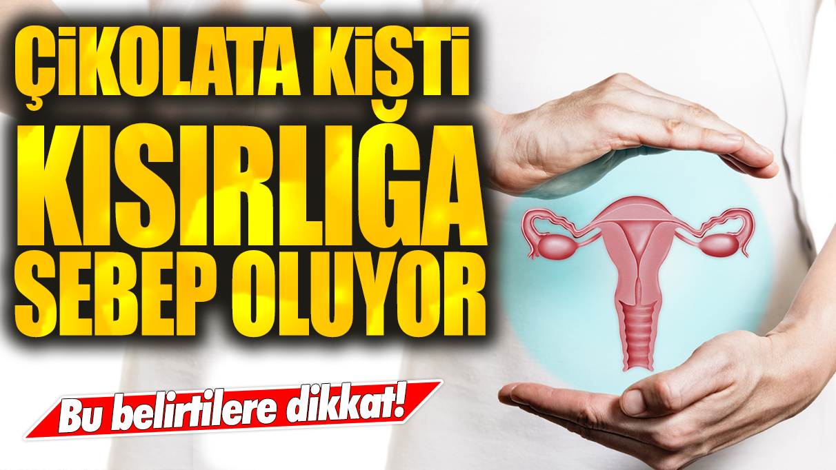 Bu belirtilere dikkat: Çikolata kisti kısırlığa neden oluyor!