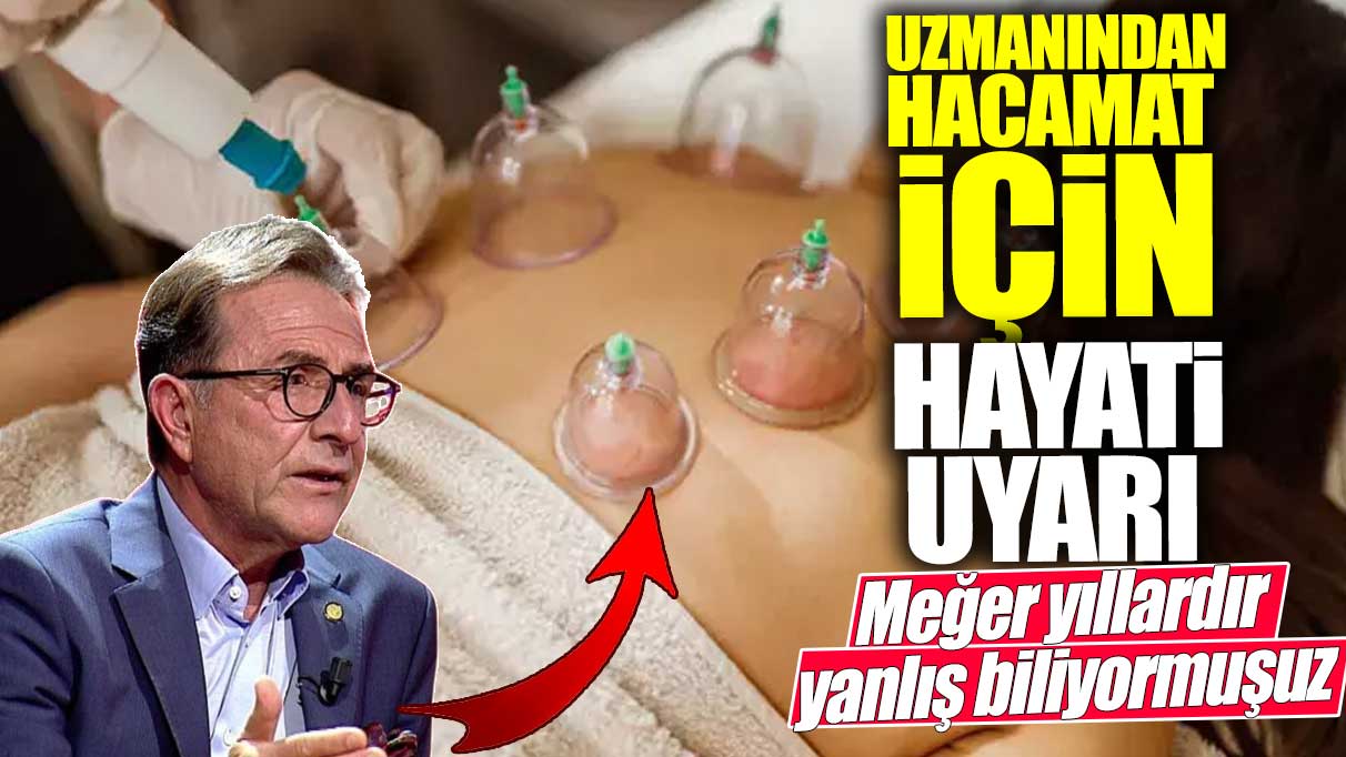 Uzmanından hacamat için hayati uyarı! Meğer yıllardır yanlış biliyormuşuz