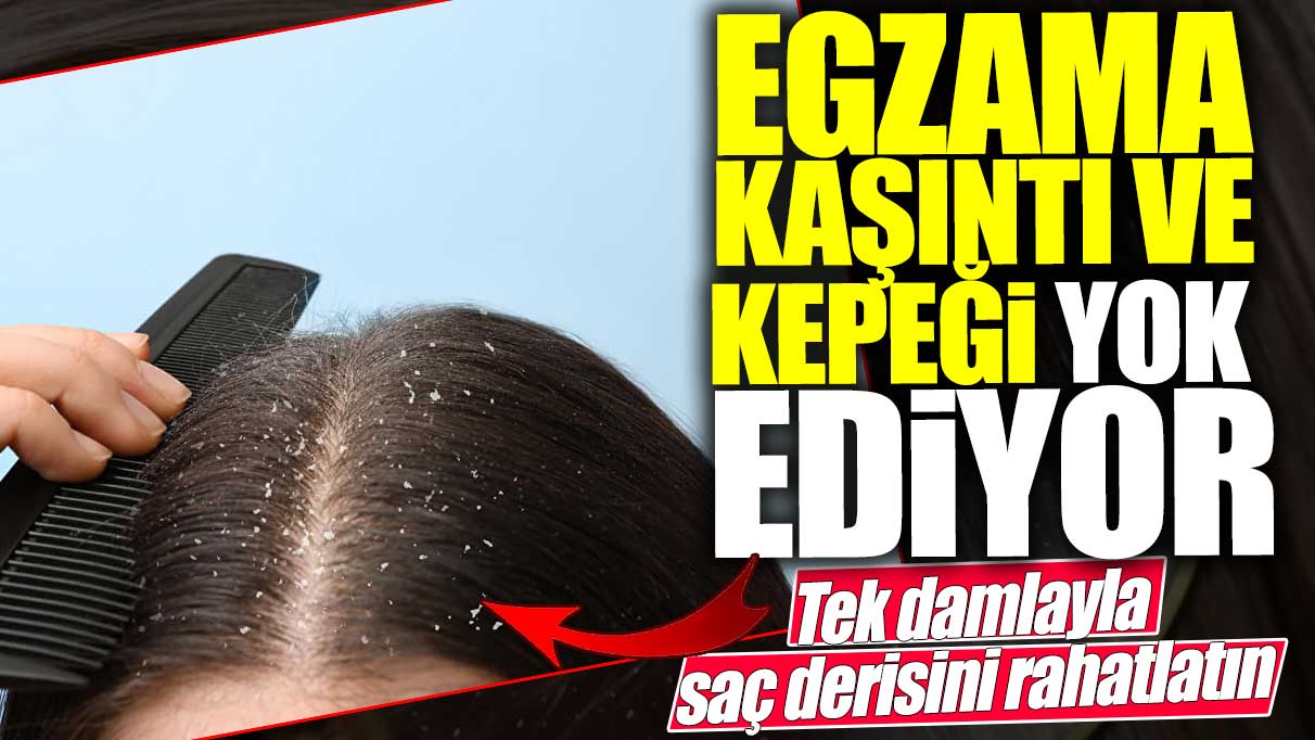 Egzama kaşıntı ve kepeği yok ediyor! Tek damlayla saç derisini rahatlatın