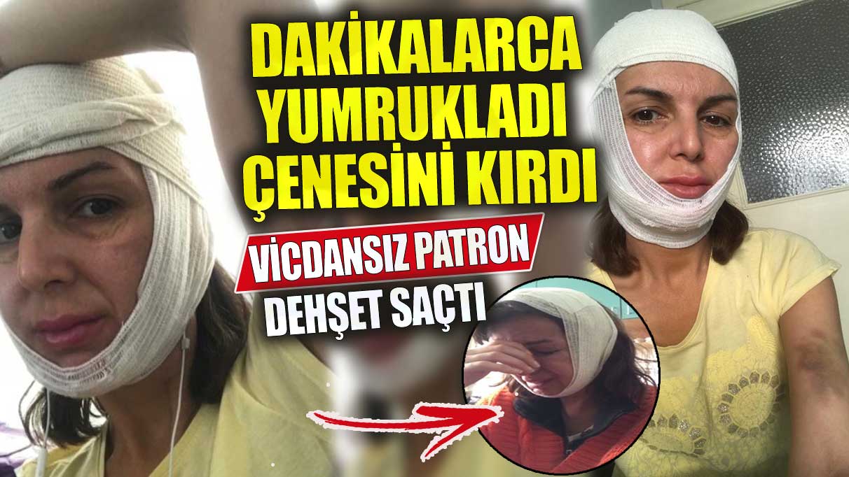 Vicdansız patron dehşet saçtı! Dakikalarca yumrukladı çenesini kırdı