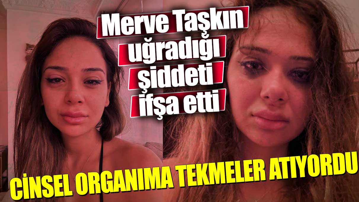 Merve Taşkın sevgilisi tarafından uğradığı şiddeti ifşa etti! Cinsel organıma tekmeler atıyordu