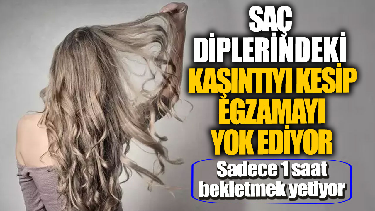 Saç diplerindeki kaşıntıyı kesip egzamayı yok ediyor! Sadece 1 saat köklerde bekletmek yetiyor