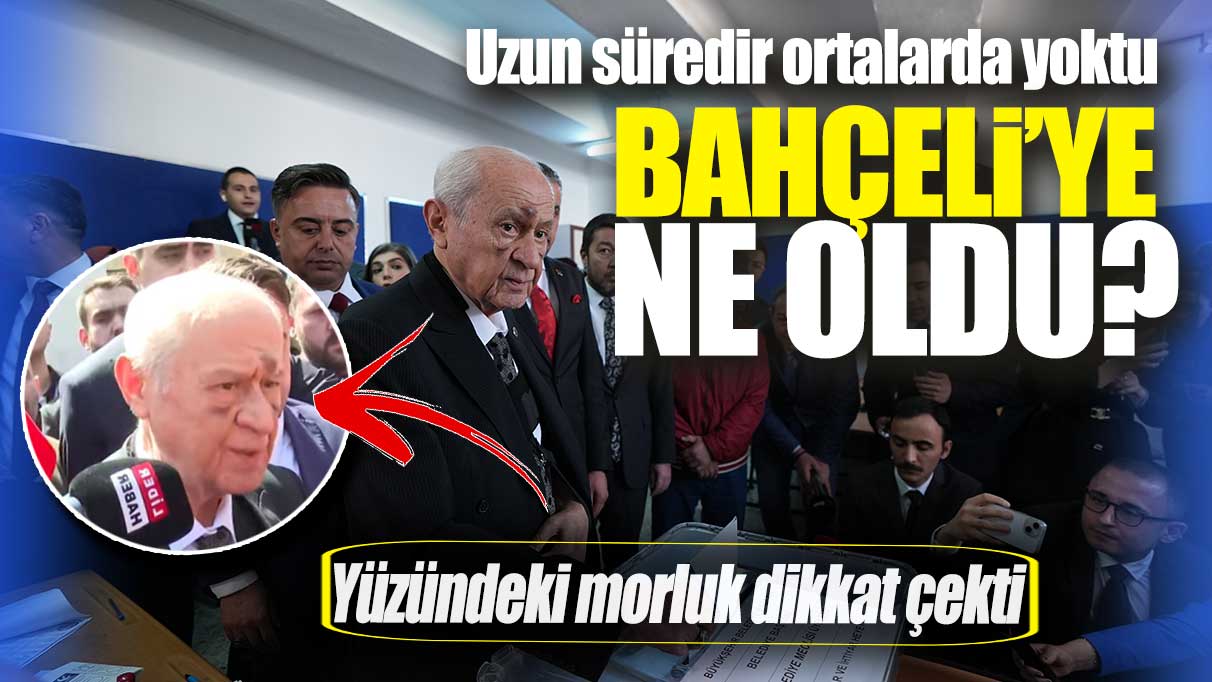 Son dakika... Günlerdir orada görünmüyordu: Devlet Bahçeli'nin suratındaki morlukları dikkat çekti.