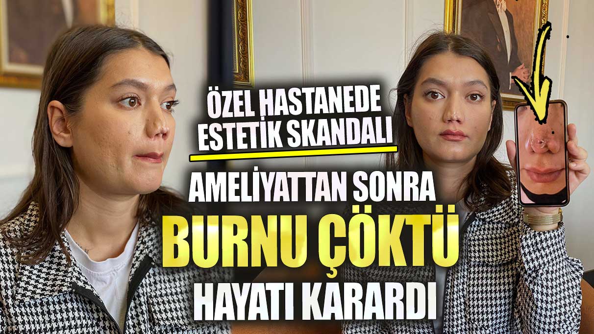 Özel hastanede estetik skandalı ameliyattan sonra burnu çöktü hayatı karardı