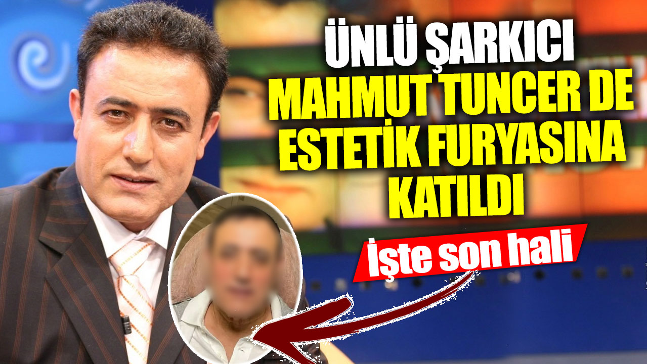 Ünlü şarkıcı Mahmut Tuncer de estetik furyasına katıldı! İşte son hali