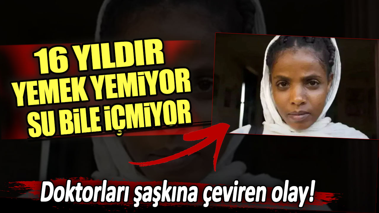 16 yıldır yemek yemiyor su bile içmiyor: Doktorları hayrete düşüren olay!