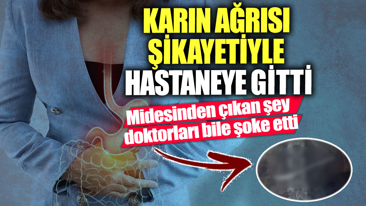 Karın ağrısı şikayetiyle hastaneye gitti! Midesinden çıkan şey doktorları bile şoke etti