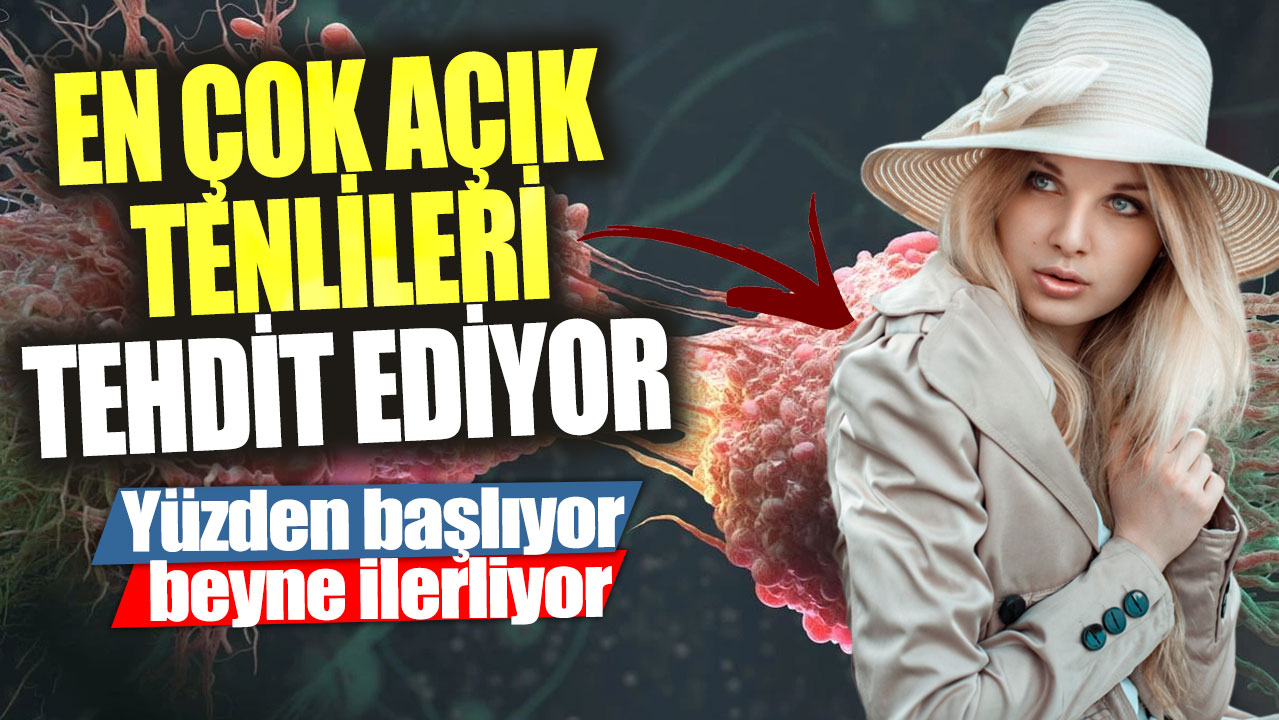 En çok açık tenlileri tehdit ediyor! Yüzden başlıyor beyne ilerliyor