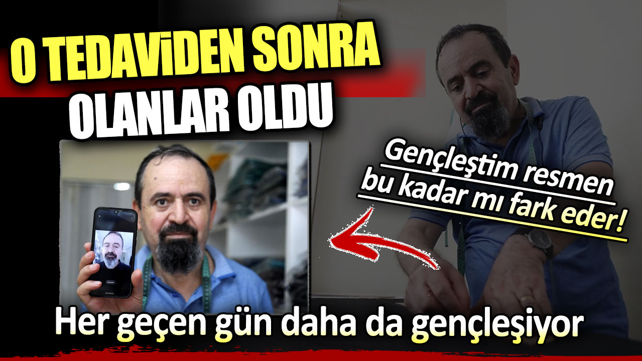 O tedaviden sonra olanlar oldu: Her geçen gün daha da gençleşiyor!