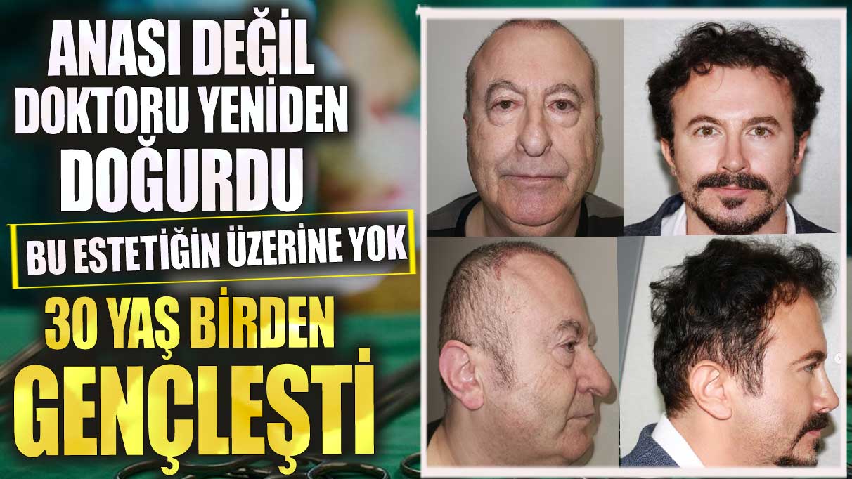 Bu estetiğin üzerine yok 30 yaş birden gençleşti! Anası değil doktoru yeniden doğurdu