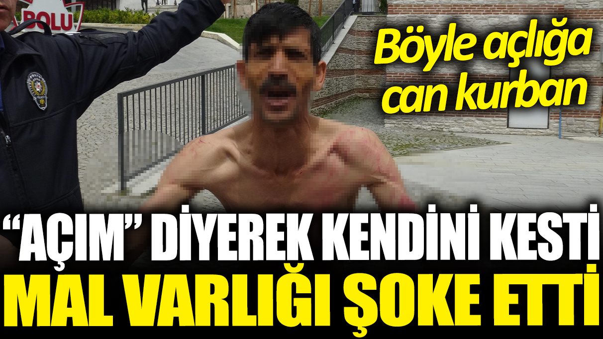 ‘Açım’ diyerek kendini kesti: Mal varlığı şoke etti! Böyle açlığa can kurban