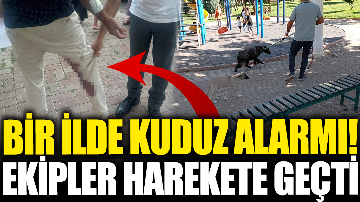 Şanlıurfa'da 'kuduz' alarmı! Saldıran köpek öldü: Vatandaş tedavi altına alındı