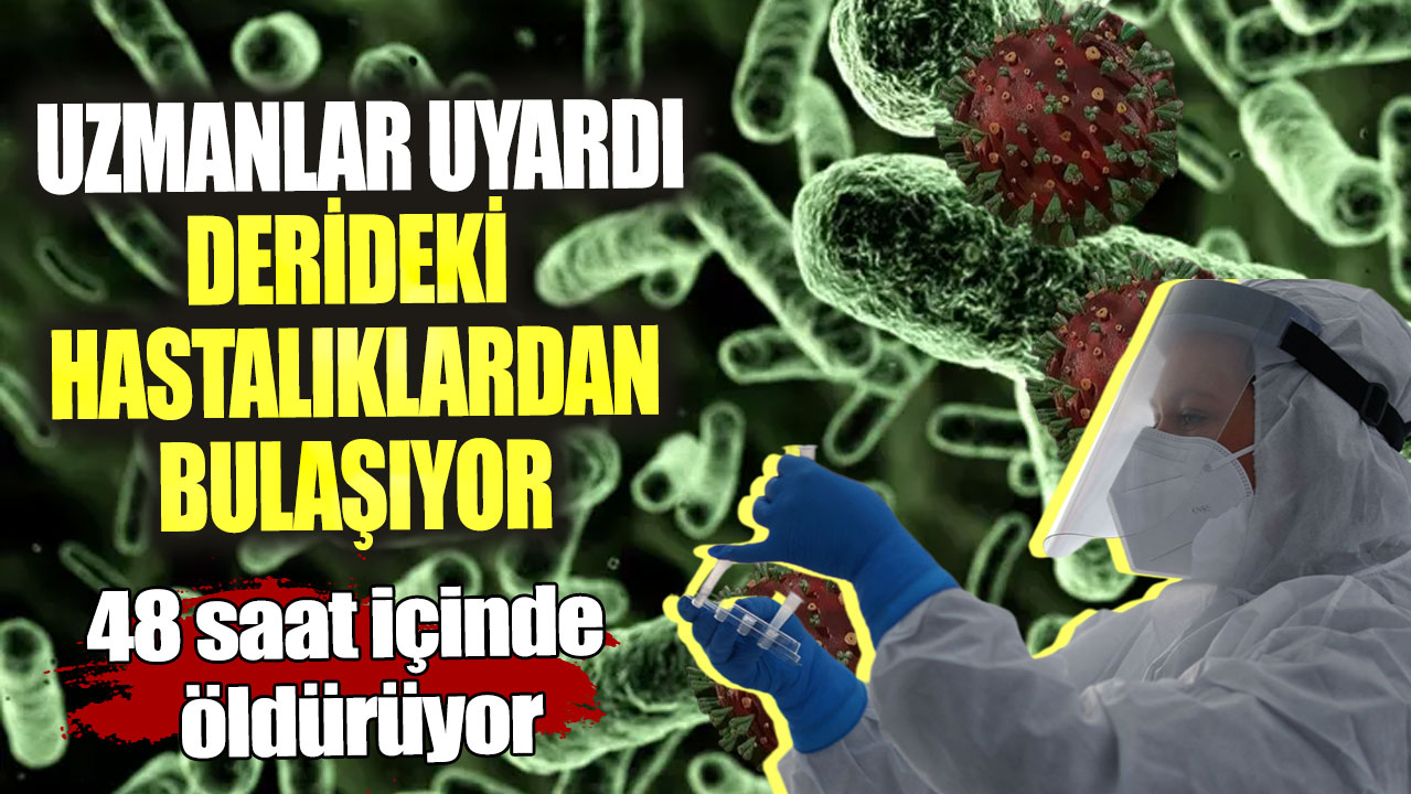 Uzmanlar uyardı derideki hastalıklardan bulaşıyor! 48 saat içinde öldürüyor