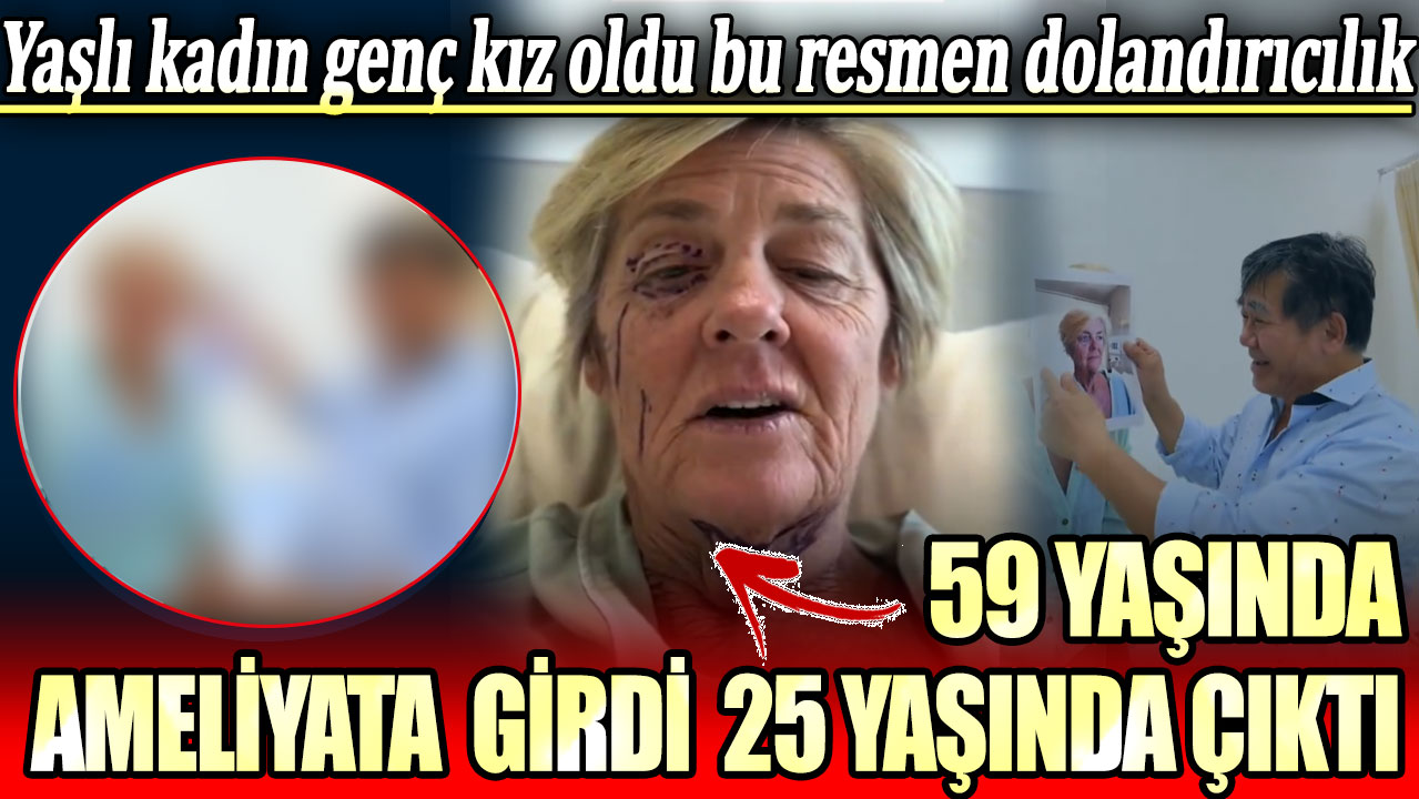 59 yaşında ameliyata girdi 25 yaşında çıktı