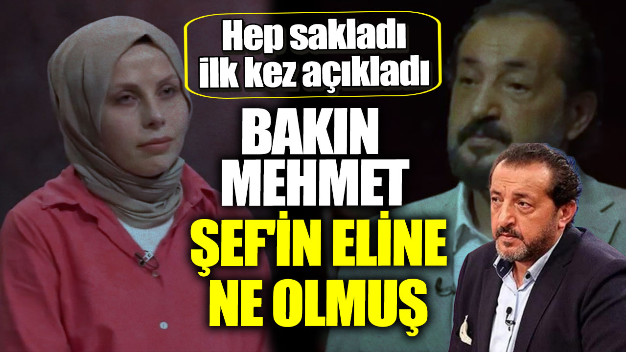 Hep sakladı, ilk kez açıkladı! Bakın Mehmet Şef'in eline ne olmuş