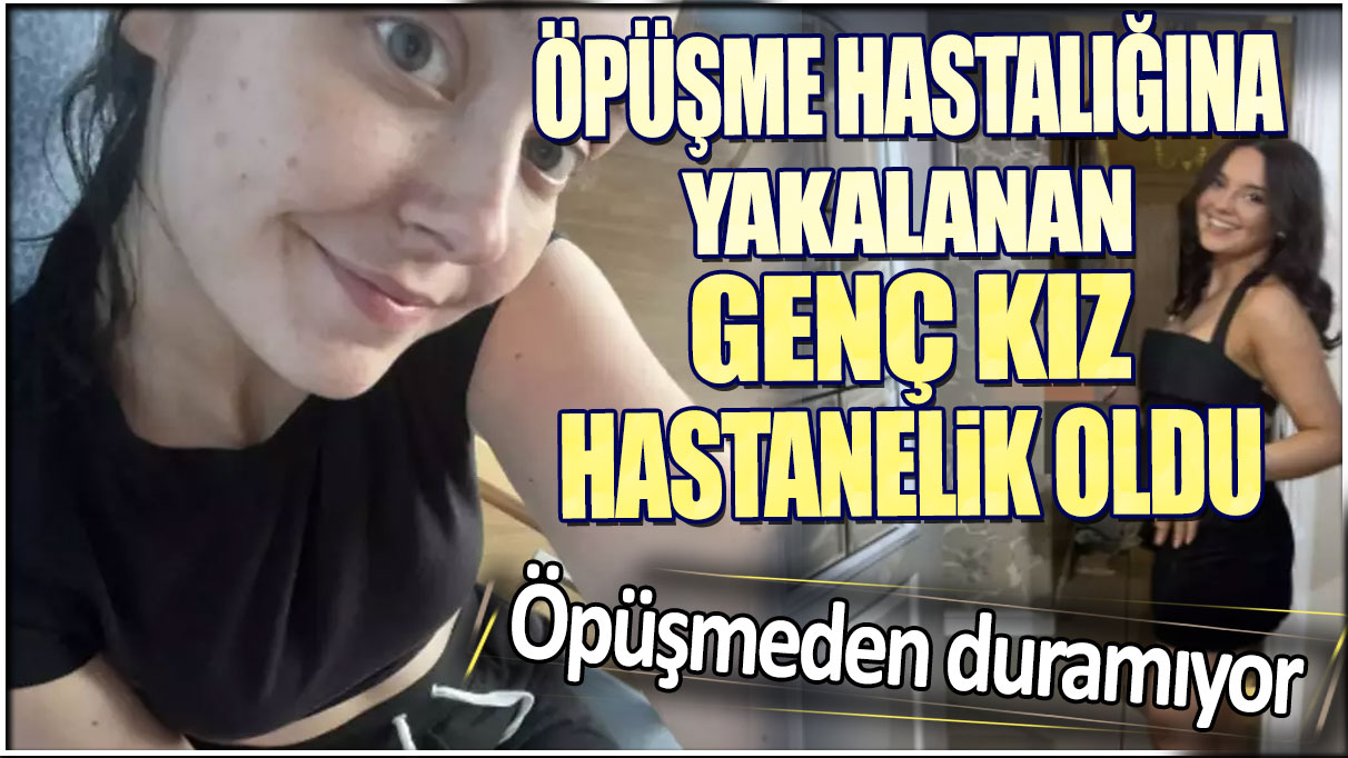 Öpüşme hastalığına yakalanan genç kız hastanelik oldu. Öpüşmeden duramıyor