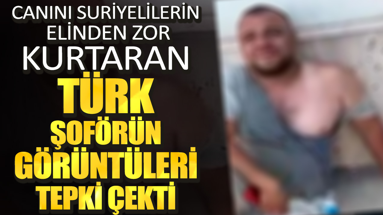 Canını Suriyelilerin elinden zor kurtaran türk şoförün görüntüleri tepki çekti